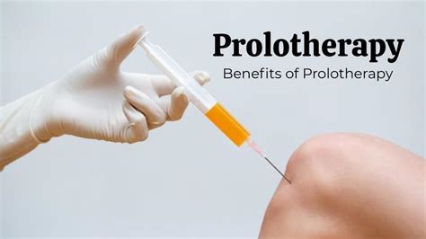 Our orthopedic doctor . . Prolotherapy near me
